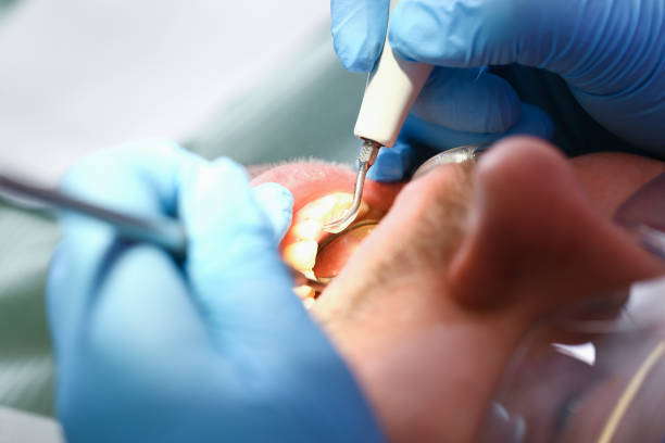 Best Pediatric Emergency Dentist in Front Royal, VA