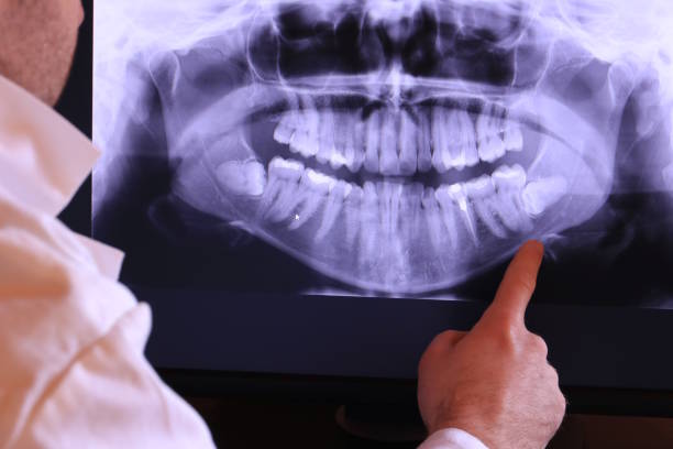 Best Emergency Dental Surgery in Front Royal, VA