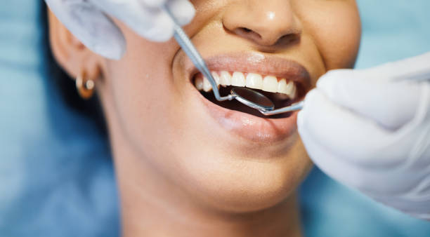 Best Emergency Tooth Extraction in Front Royal, VA