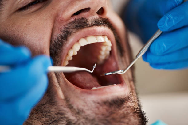 Best Weekend Emergency Dentist in Front Royal, VA